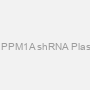 Rat PPM1A shRNA Plasmid